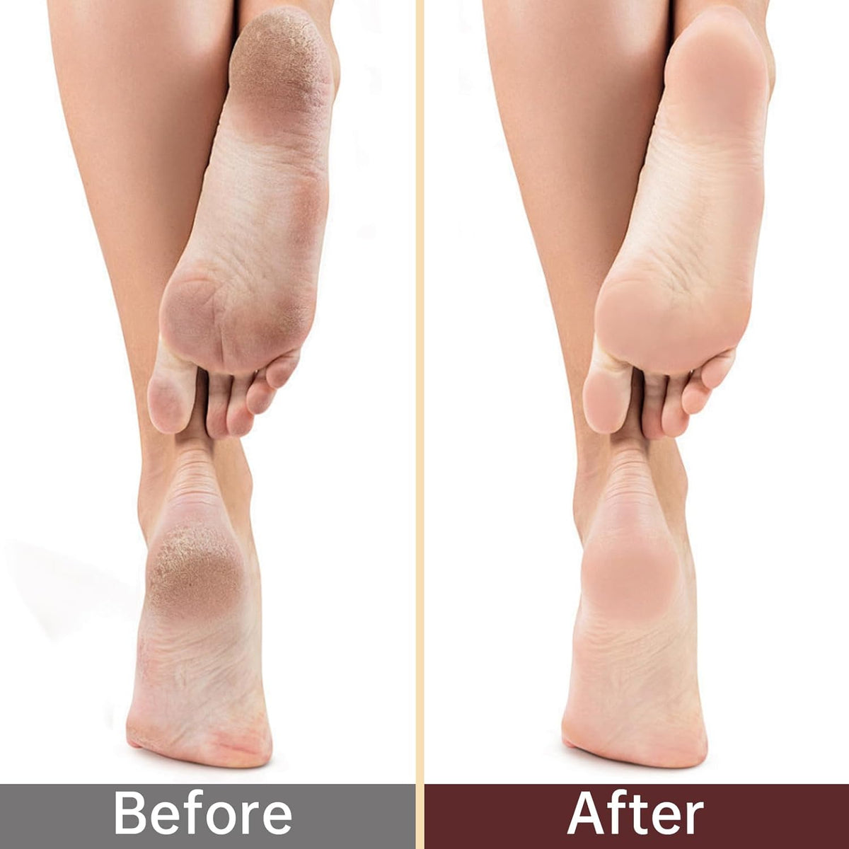 BLMHTWO 4 Pairs Moisturizing Socks, Overnight Foot Care, For Dry Cracked Feet, White Cotton