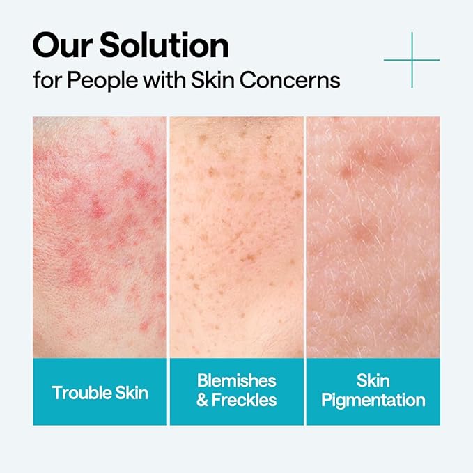 Mediheal Madecassoside Repair Serum 1.35 fl.oz - Blemish Care, Fades Pigmentation and Freckles & Skin Soothing & Hydration - with Centella Asiatica, Niacinamide