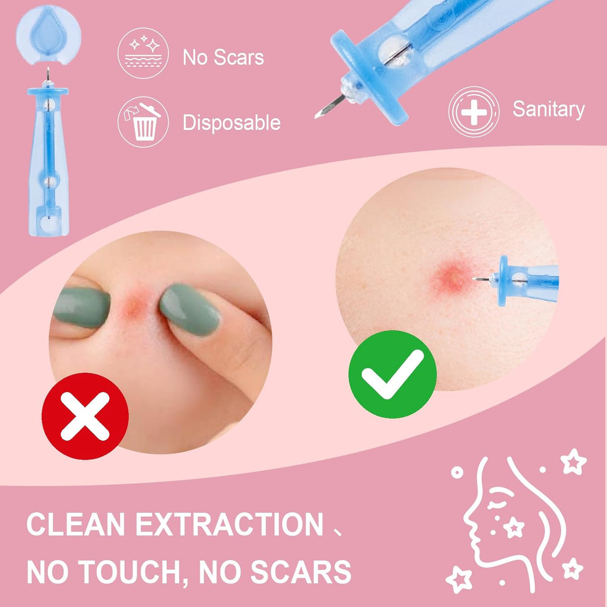 Pimple Patches Set with Microdart Pimples Patche and Hydrocolloid Patch – 3-Step Acne Kit for Fast Blemish Removal, Blackhead Extractor Tools, Zit Patches for Face