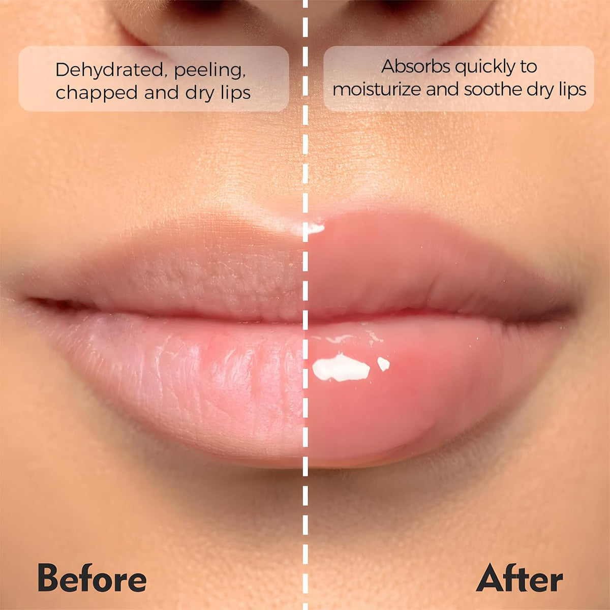 Deep Hydrating Lip Butter Balm | Plump & Nourish with Shea Butter, Vitamin E, Peptides & Hyaluronic Acid | Vegan, Non-Sticky, Anti-Aging Lip Treatment Care | 2-Pack (Clear-Unscented)
