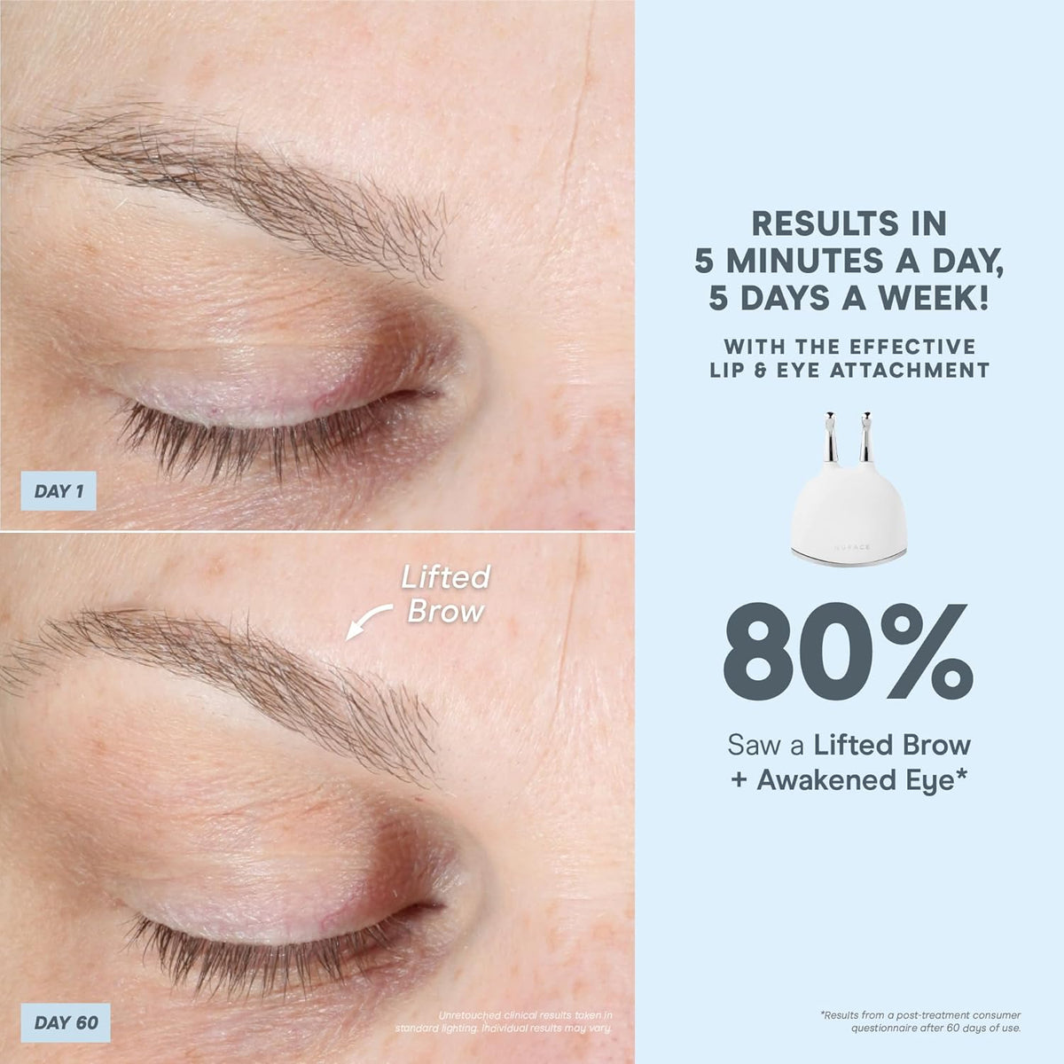 NuFACE TRINITY+ Effective Lip & Eye Attachment for Microcurrent Facial Device - FDA Cleared At Home Eye Lift & Smile Lines Treatment to Tighten & Tone Hard-to-Reach Areas Around Mouth and Eyes