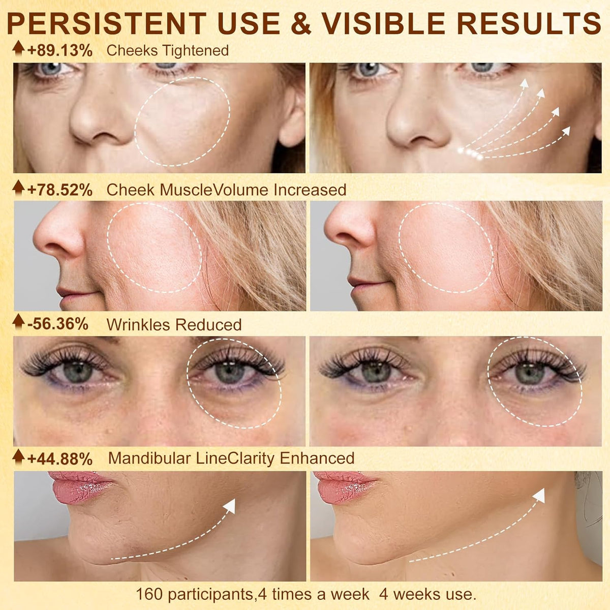 Microcurrent Facial Device,Radio Frequency Skin Tightening Face Machine Treatment of Facial Wrinkles and mild to Moderate inflammatory