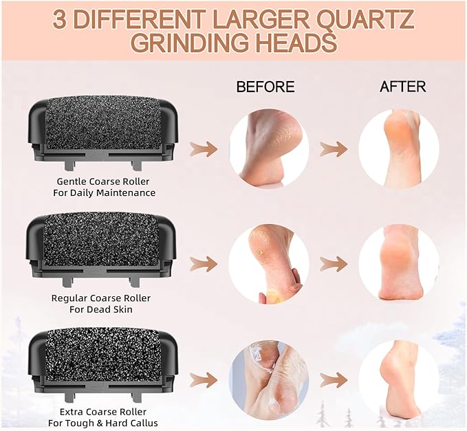 AdamPark Callus Removers 8 Pack Replacement Rollers Heads for Electric Feet File Pedicure Tools, Pedicure Kit Refill Rollers 3 Extra Coarse, 3 Regular Coarse, 2 Fine Coarse Refill Rollers