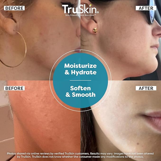 TruSkin Hyaluronic Acid Serum for Face + 7 Ultra Hydrating Ingredients – Best Face Serum for Moisturizing, Visibly Plumping Skin & Smoothing the Look of Fine Lines, 1 fl oz