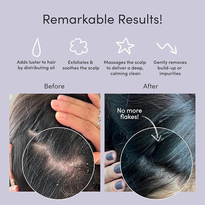 Jupiter Scalp Exfoliator Brush, Detangling Scalp Scrubber Brush, for Wet or Dry Hair, Removes Dandruff & Build-Up, Supports Circulation, Ergonomic Scalp Massager, Good for All Hair Types, White