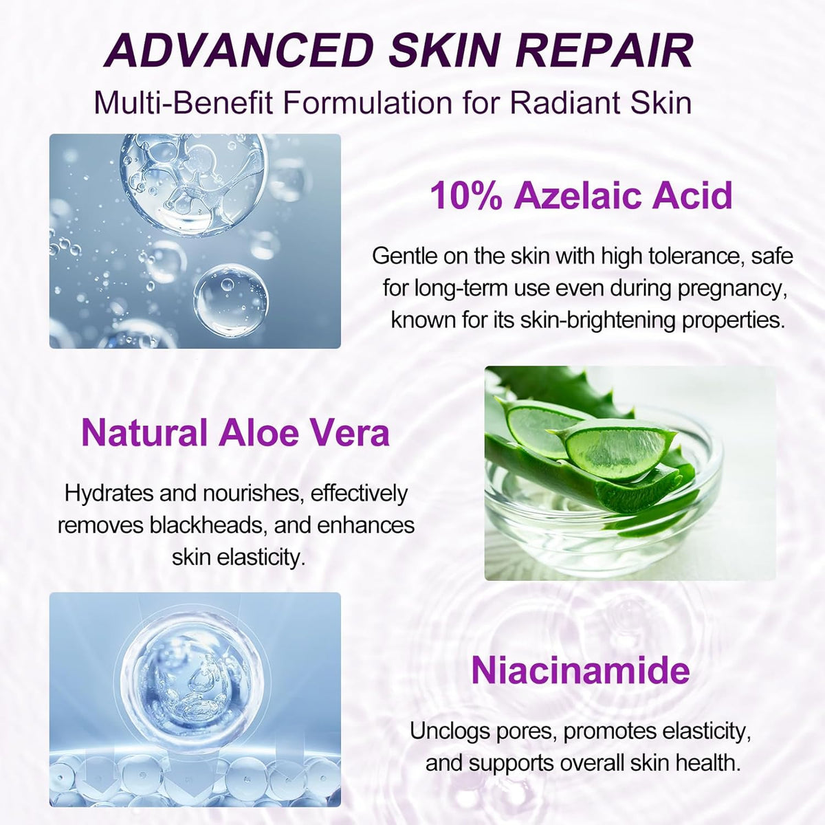 Azelaic Acid Serum - Azelaic Acid 10% for Acne Treatment - Fast Rosacea Skin Care - Redness Relief Face and Boost Skin Radiance with Niacinamide & Vitamin B3, B5 and Hyaluronic Acid, 1 Fl Oz