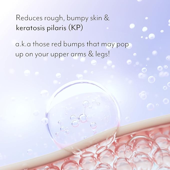 Bliss Body Butter Texture Takedown Skin Smoothing Lotion - Keratosis Pilaris KP - 6.7 Fl Oz - For Rough, Bumpy Skin - 10% AHA + Squalane + Shea Butter - Clean - Vegan & Cruelty-Free