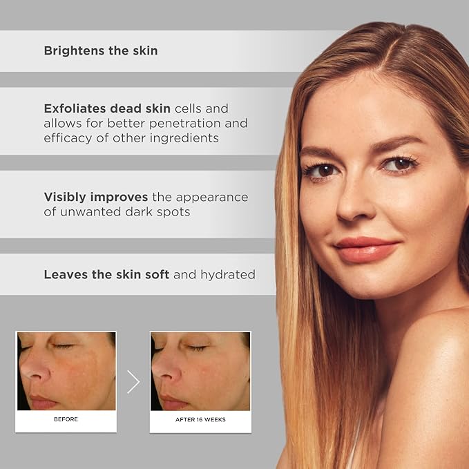 Glytone Enhance Brightening Complex - With 12% Azelaic Acid, 3% Glycolic Acid - Brightens Skin & Reduces Dark Spots - Non-Comedogenic - 1 fl. oz.