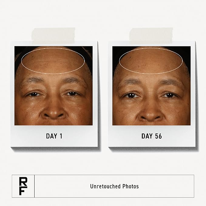 RODAN + FIELDS Redefine Overnight Reparative Lotion | Anti Aging Face Moisturizer for Fine Lines, Deep Wrinkles, and Firmness | With Peptides, Retinol, and Vitamin B3 | Lightweight Skin Care