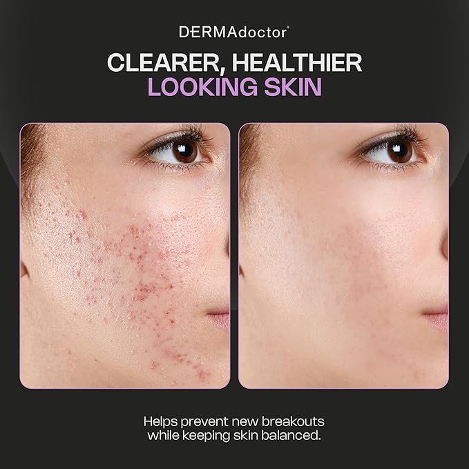 DERMAdoctor Sulfur Acne Treatment - Clay Mask & Acne Spot Treatment | Face Mask Blackhead Remover - Bentonite Clay Detox | Non-Irritating Non-Drying Calming & Soothing with Natural Exfoliants - 2.3 Oz