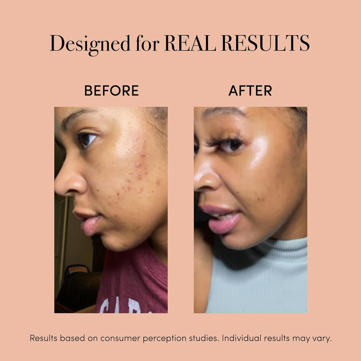 reVive Glo Multi-Spectrum Acne Tools, Medspa-Quality Red & Blue Light Wand, FDA-cleared Face Tools for Skincare, Science-Backed LED Light Therapy Products