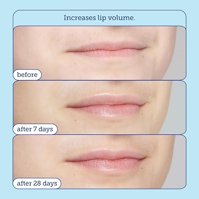 Skinfix Barrier+ Triple Lipid Lip Treatment: Nourish Dry, Chapped Lips With Our Volumizing Complex to Visibly Plump & Fill Fine Lines, 0.27 Oz