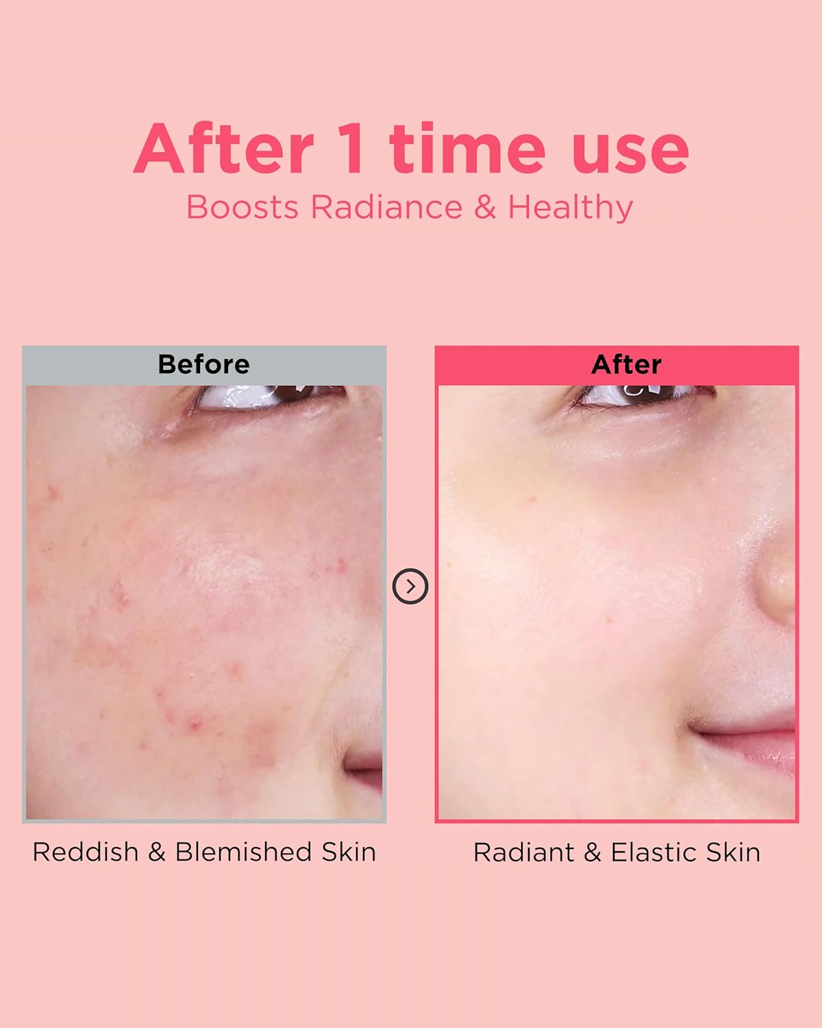 EASYDEW DW-EGF Peptide Re-DERMA Master Ampoule - Korean Anti-Aging Skincare Facial Serum - Firming, Restore skin vitality, Smooth fine lines and wrinkles with Oligo peptide, Niacinamide - 0.42fl. oz.
