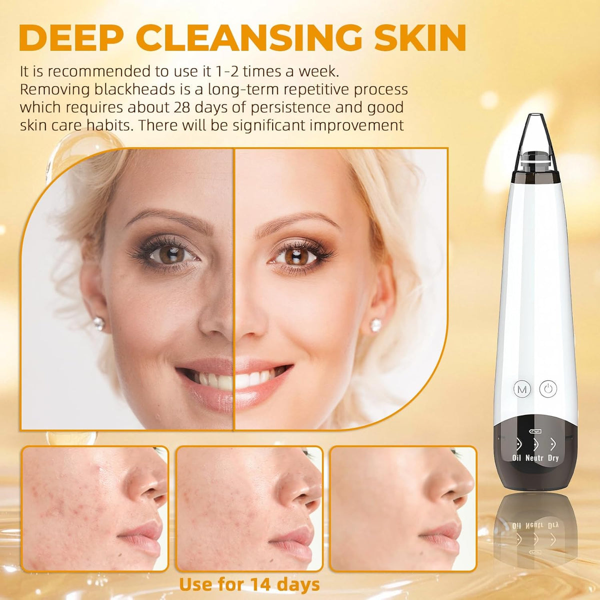 Pore Vacuum, USB Rechargeable Blackhead Remover Vacuum,3 Levels Adjustable Pore Vacuum Blackhead Remover, with 6 Suction Power Probe,4 Golden Needle,Face Vacuum Pore Cleanser for Women & Men-White