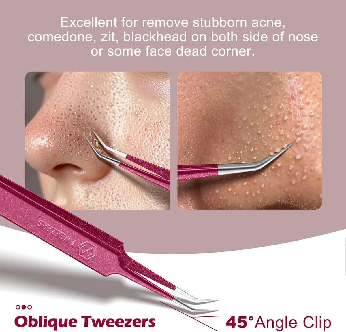 WSYUB Blackhead Remover Tweezers,Professional Facial Blackhead Tweezers,Ingrown Hairs TweezersPimple Popper Tool Kit, Dermatologist Tweezers for Acne Removal, Extraction Tweezers