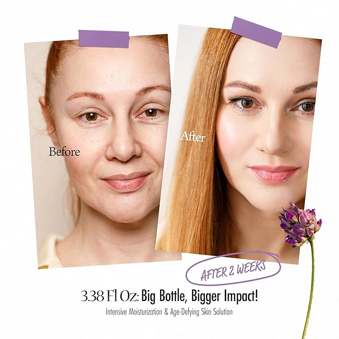 VELY VELY Bakuchiol Super Biome Lifting Ampoule Serum - Age-Defying Hydrating Firming Pore Serum Ampoule Korean Skin Care - Hypoallergenic Bakuchiol Oil Face Moisturizer w/Niacinamide (3.38 fl oz)