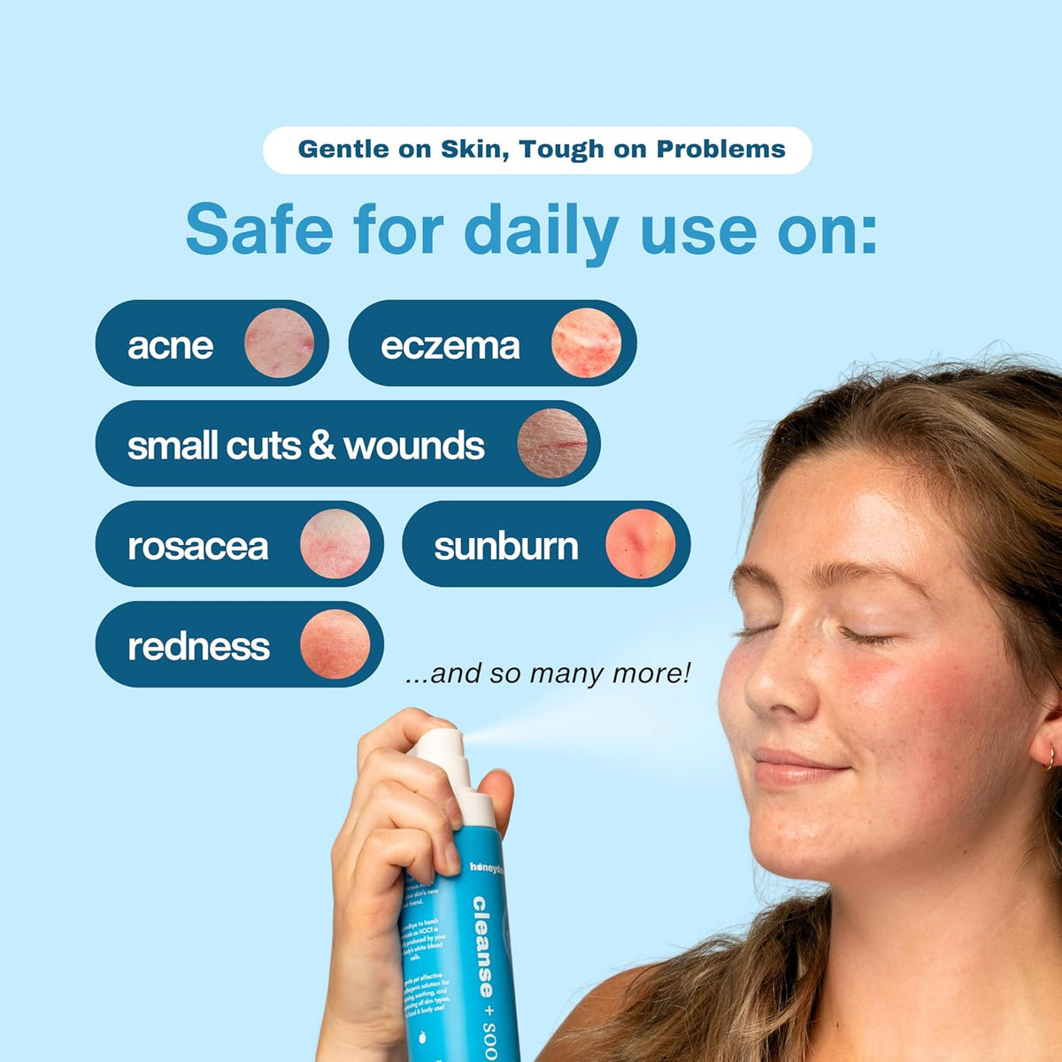 Hypochlorous Acid Spray - HOCL - Hypoallergenic Skin Toner Cleanse and Soothe Sensitive Face - Acne - Eczema - Bacne - Eyelid - Pre Post Workout (Mini Bundle Pack - 2fl + 2 fl)