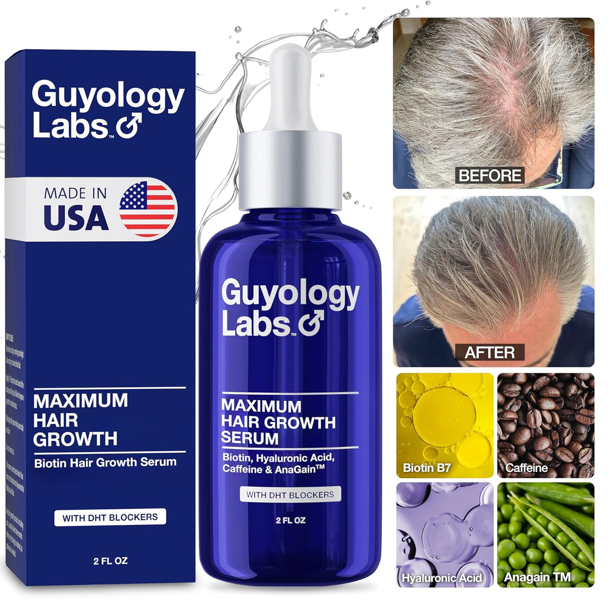 "Guyology Labs Biotin Hair Growth Serum for Men, Women & All Types of Hair - DHT Blocker & Scalp Serum - Hyaluronic Acid, Citrus - Anti Thinning Hair - Anti Hair Loss - Hair Regrowth - Made in USA"